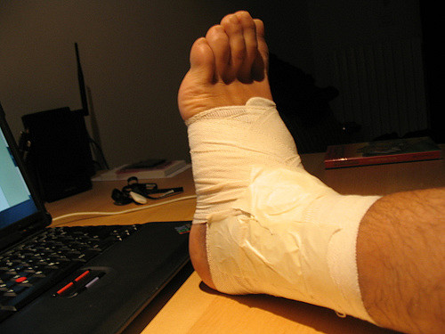 bandaged foot
