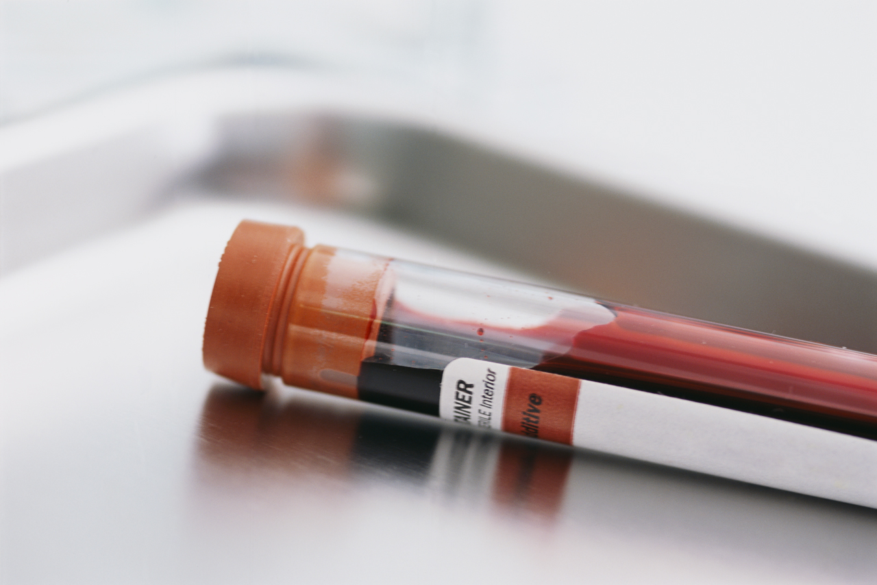 Blood Sample