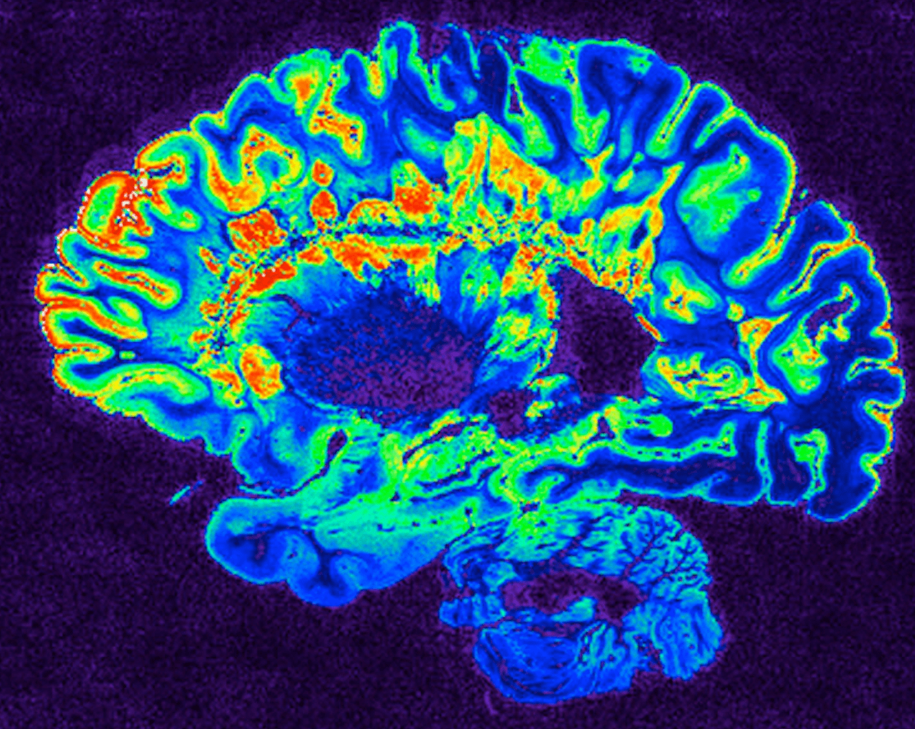 brain