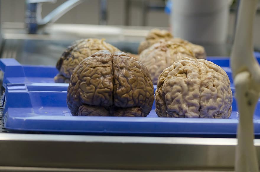 the-brain-medical-science-surgery-hospital-the-body-of